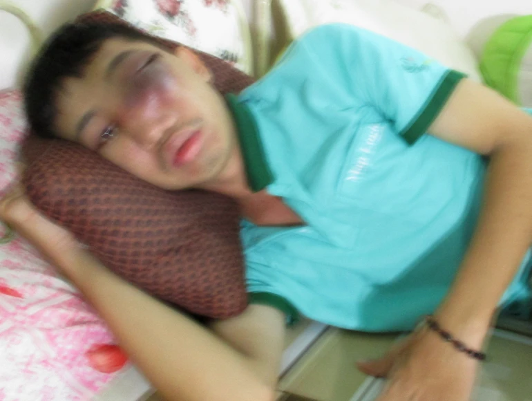 Giúp em Tùng điều trị ung thư mắt